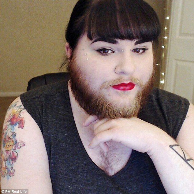 Woman With PCOS Grows A Full Beard Afte